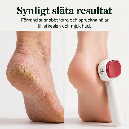Fotessa™ | Skador i huden är inte permanenta